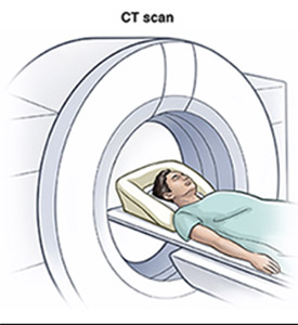 Image of patient in a CT scan