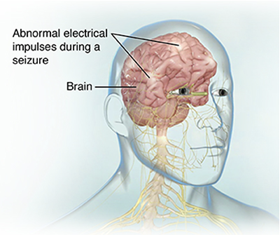 Image of electrical impulses